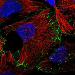 LIN-41/TRIM71 Antibody, Novus Biologicals 0.1mL; Unlabeled:Antibodies,
